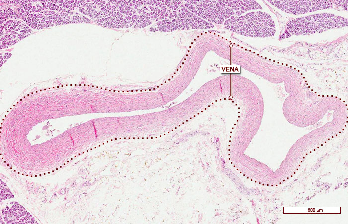 “Imágenes microscópicas del aparato circulatorio.” Histología en la Red, Universidad de Zaragoza, wzar.unizar.es/acad/histologia/inicio.html.